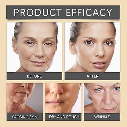 OUHOE - Bee Venom Botox Wrinkle Cream